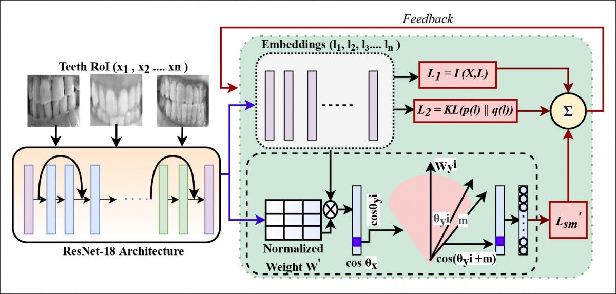 The loss function architecture of DeepTeeth.