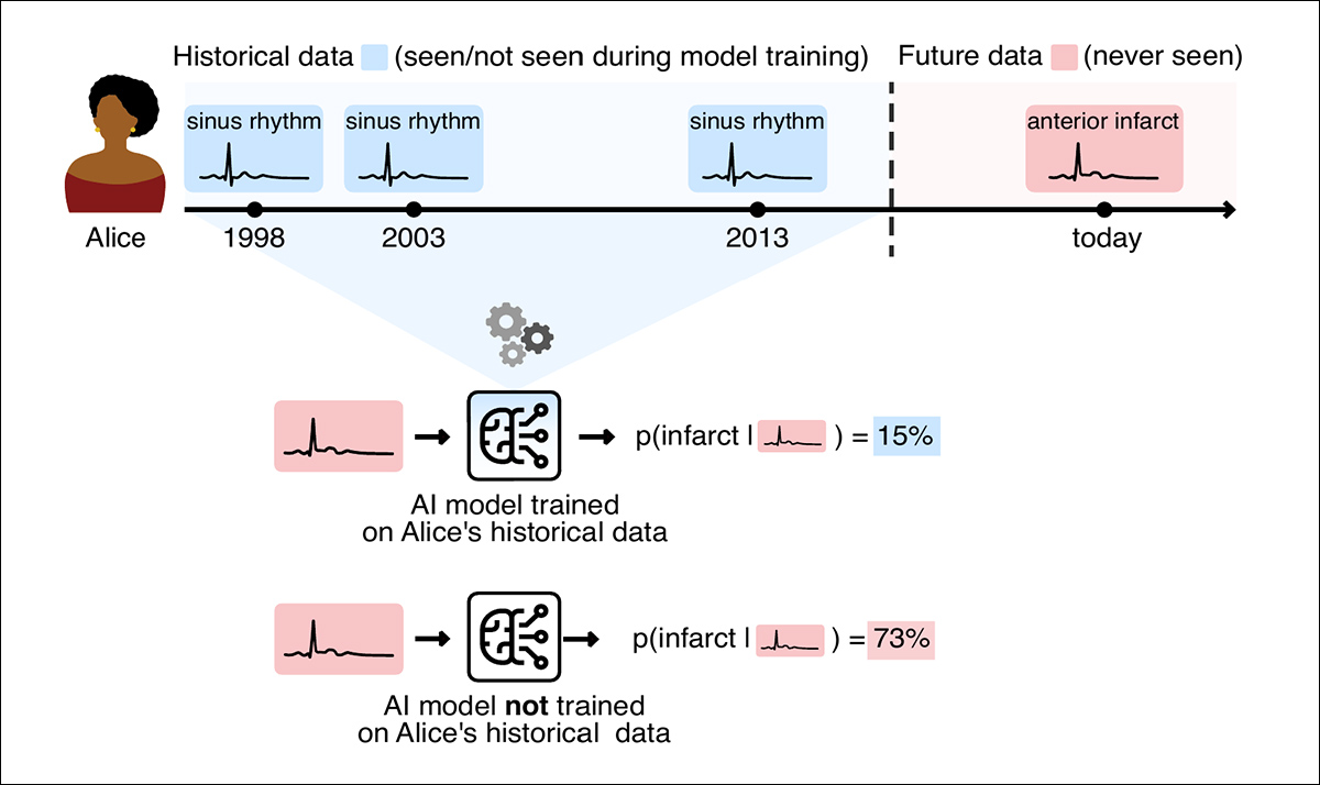 From the new paper, an illustration of how memorization bias can affect a returning patient. A model trained on Alice’s earlier healthy ECGs assigns just a 15% probability to her later heart attack, compared with 73% for a model that never saw her historical records. Source - https://arxiv.org/pdf/2609.17223